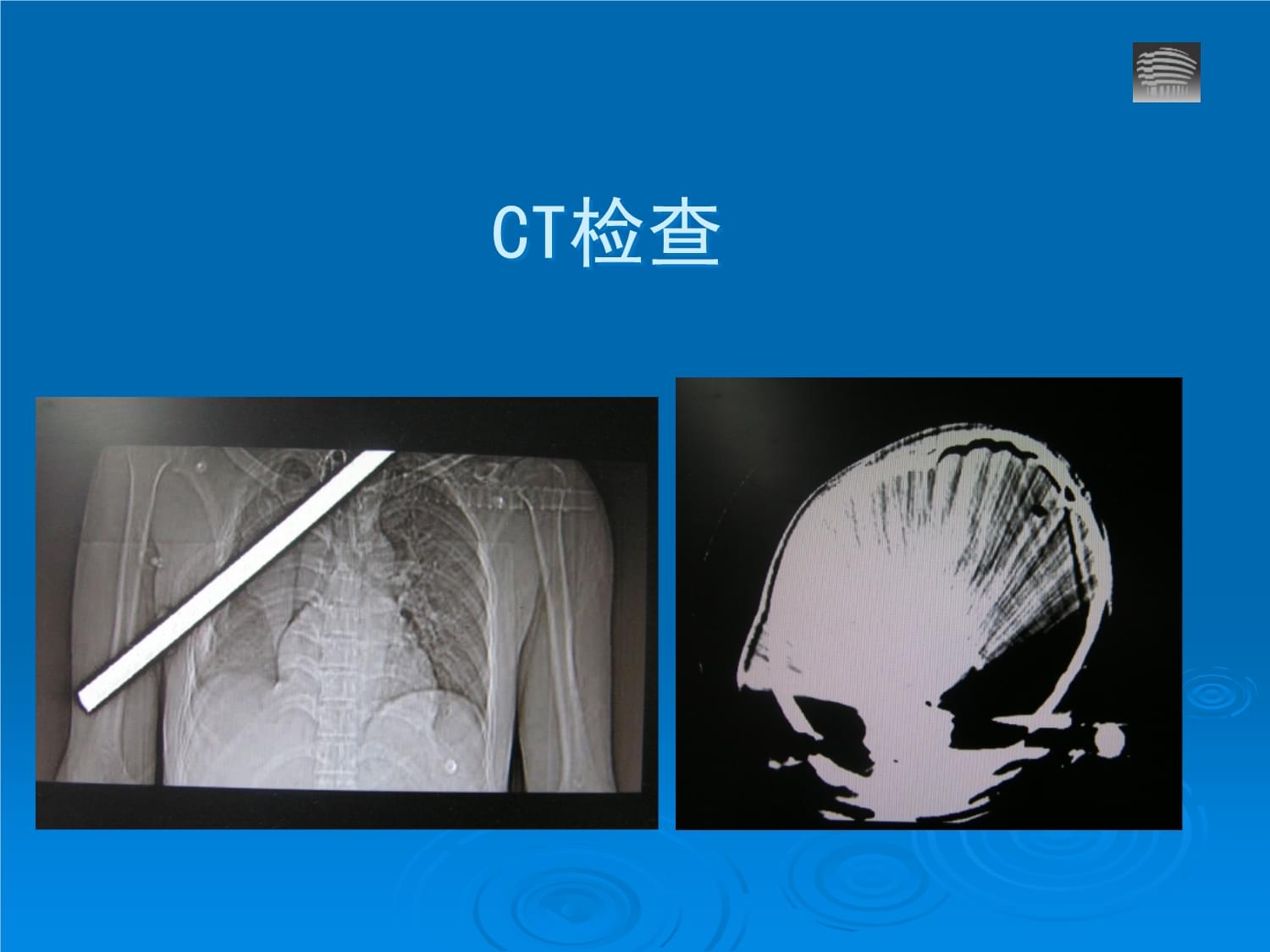 颅脑损伤中文通用课件_第4页