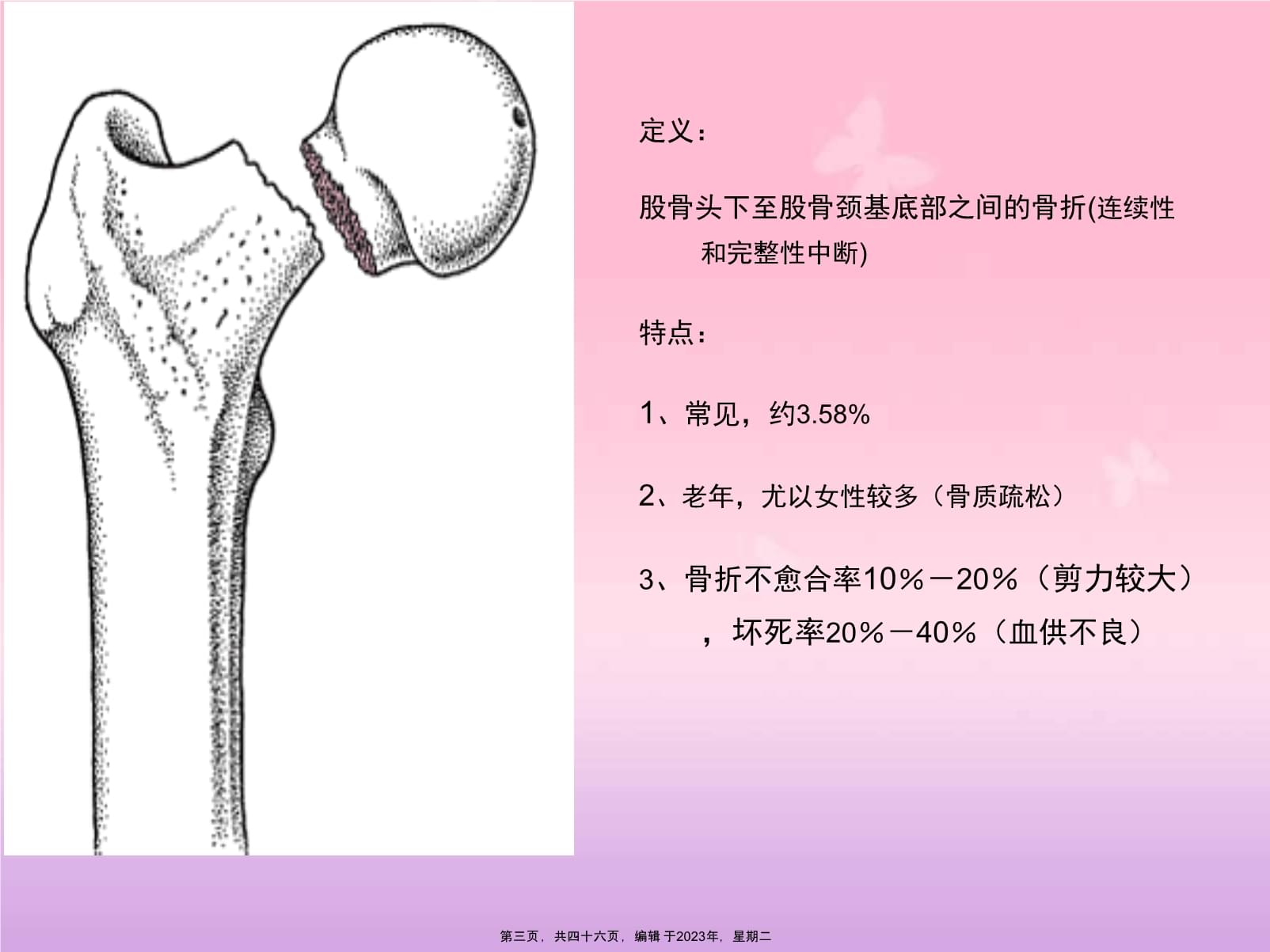 髋关节置换术病人护理查房_第3页