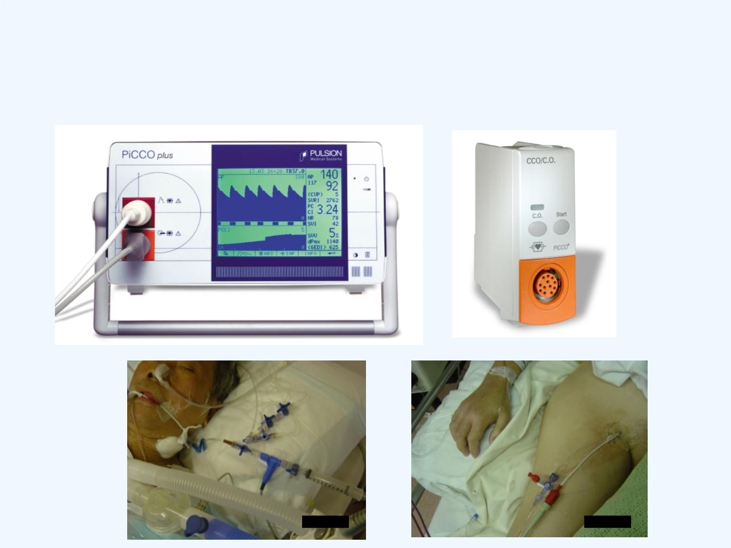 PiCCO的应用及护理课件_第4页