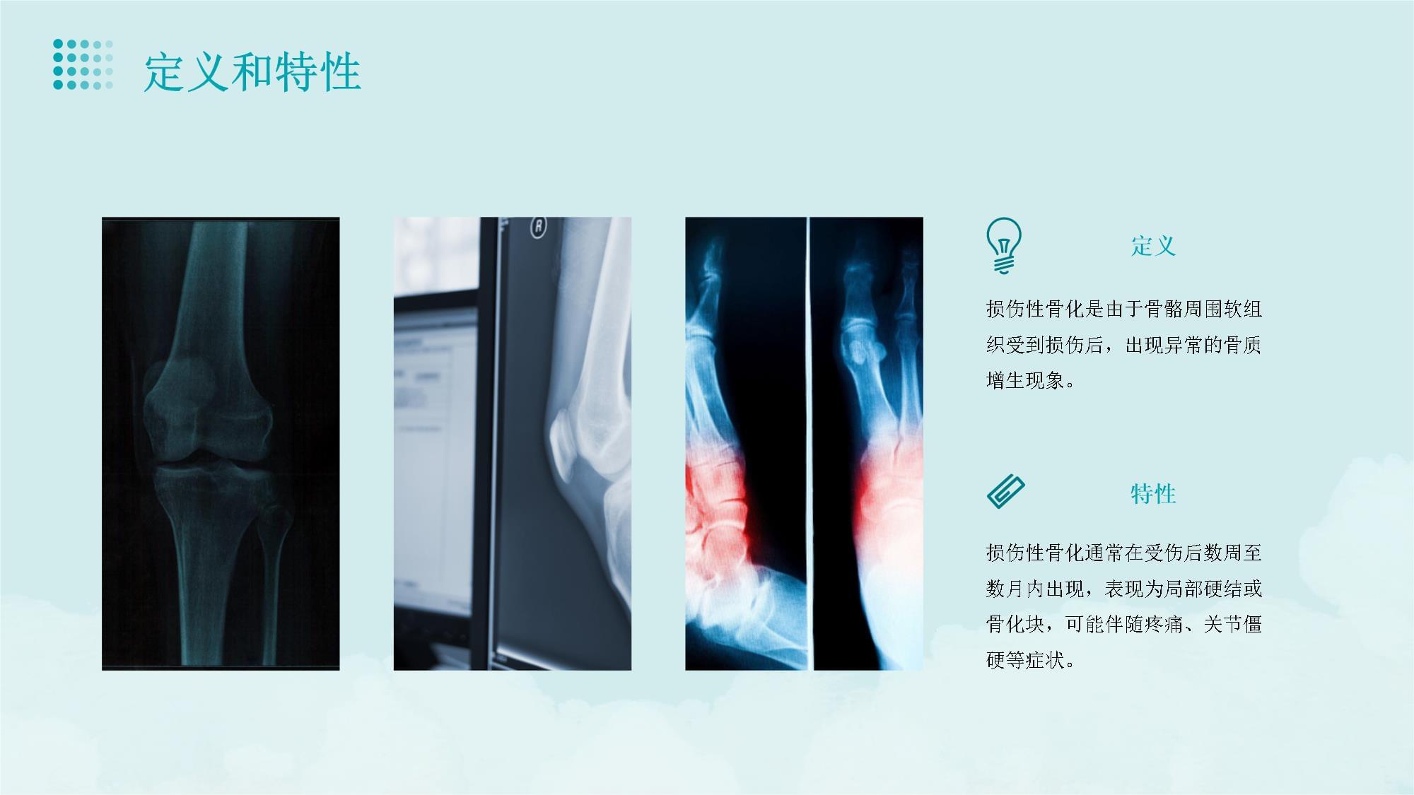 损伤性骨化预防课件_第4页