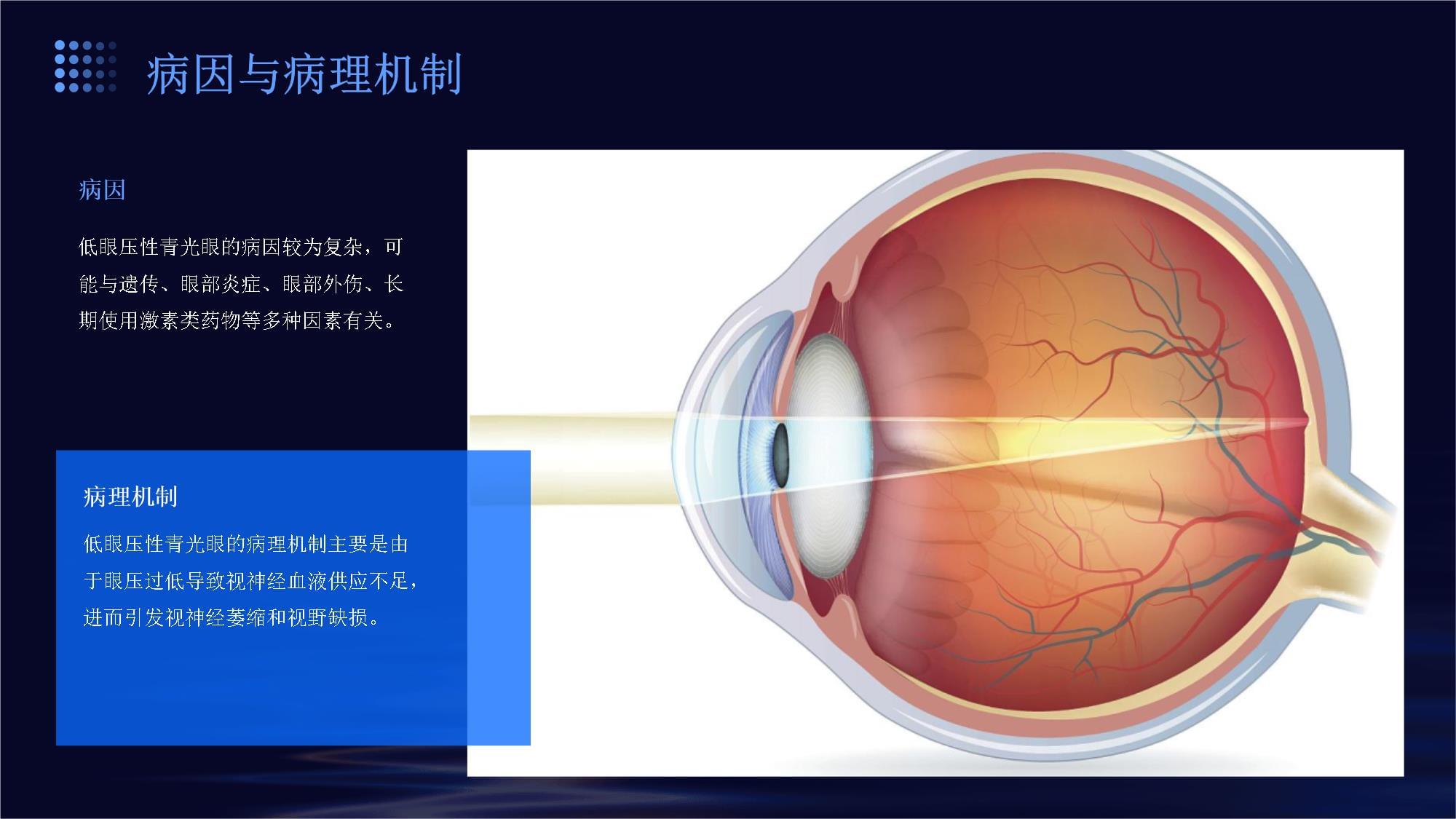 低眼压性青光眼的护理_第5页