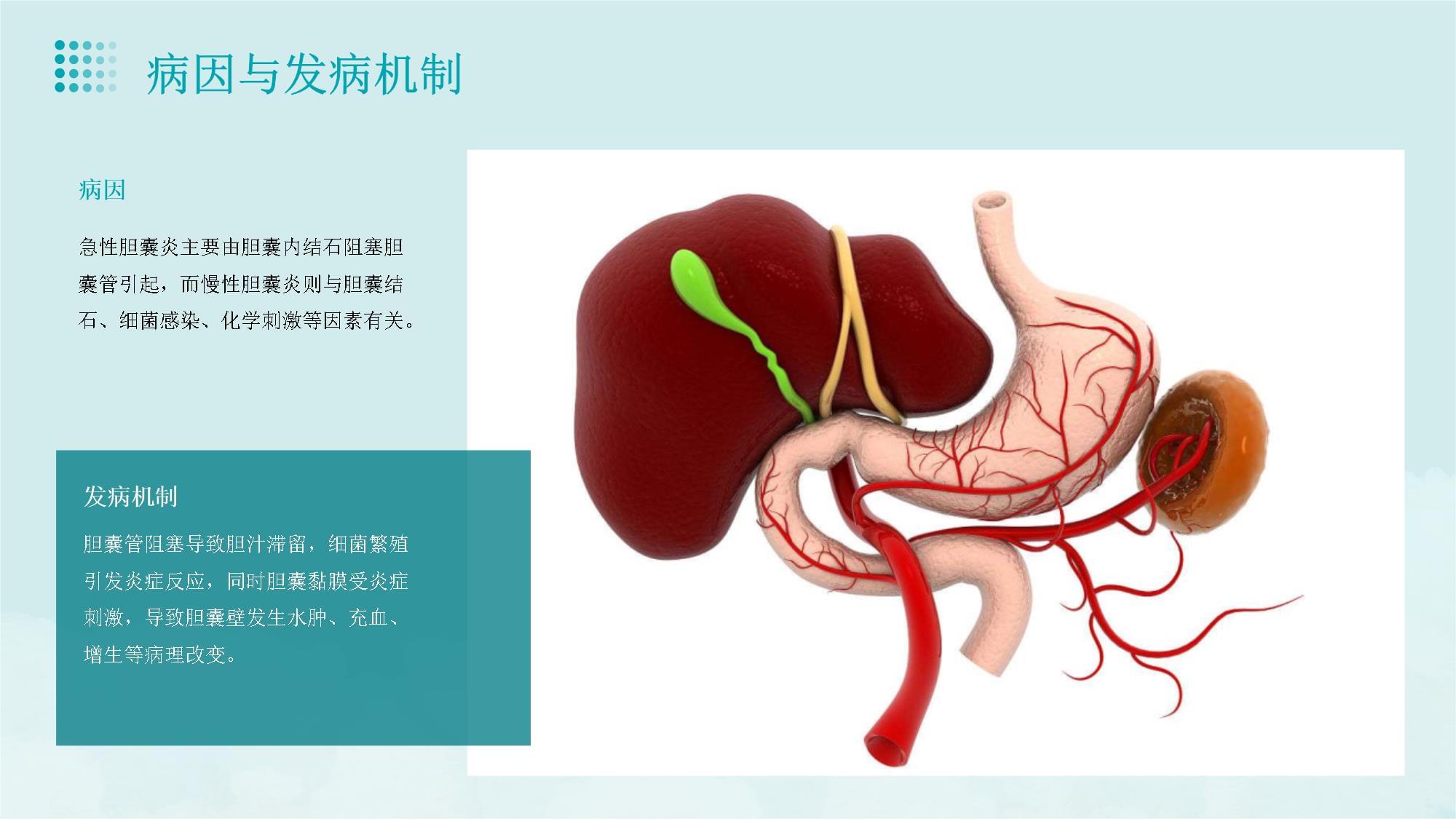 胆囊炎健康宣教课件_第5页