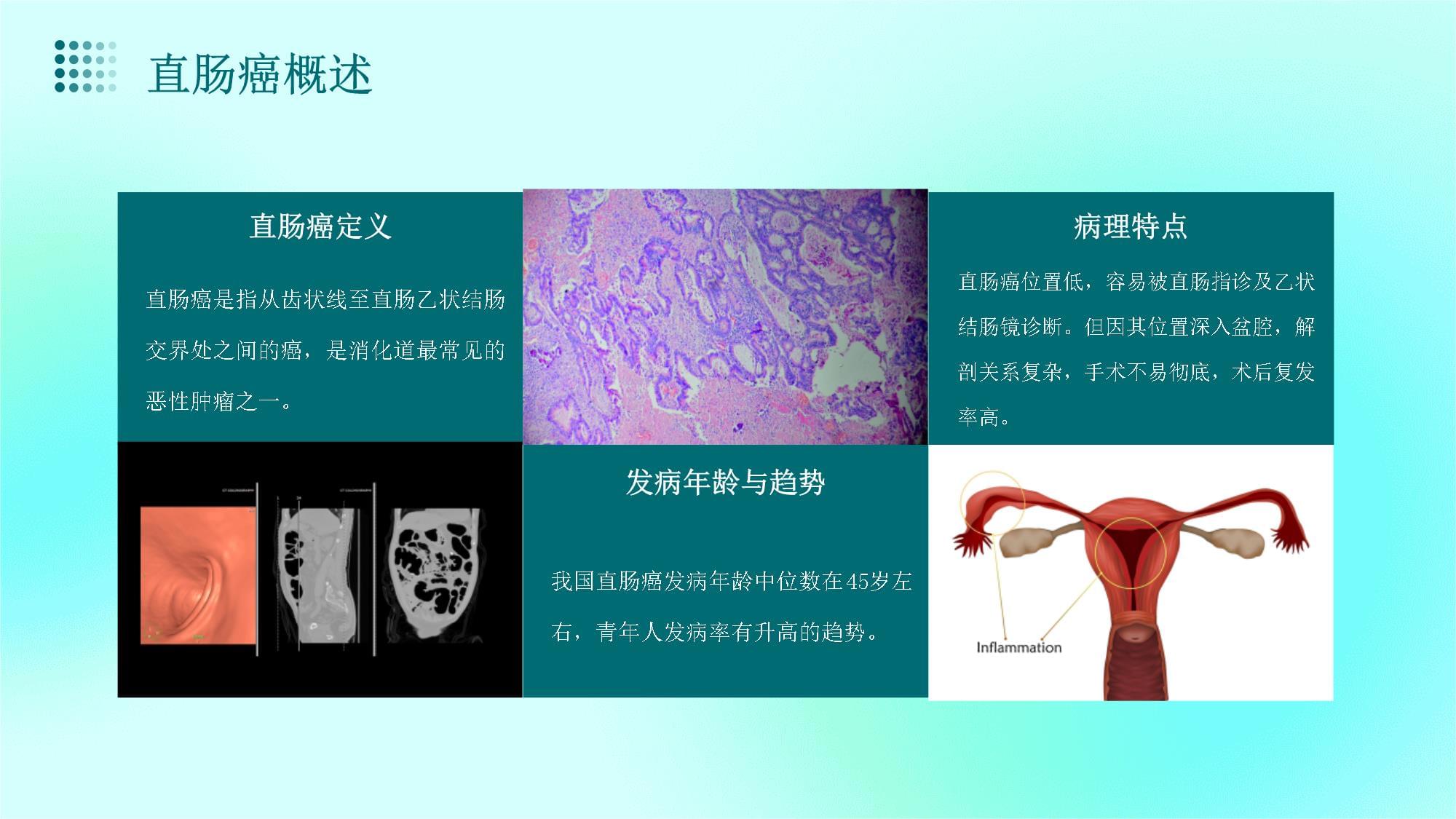 直肠癌：MRI与临床_第4页