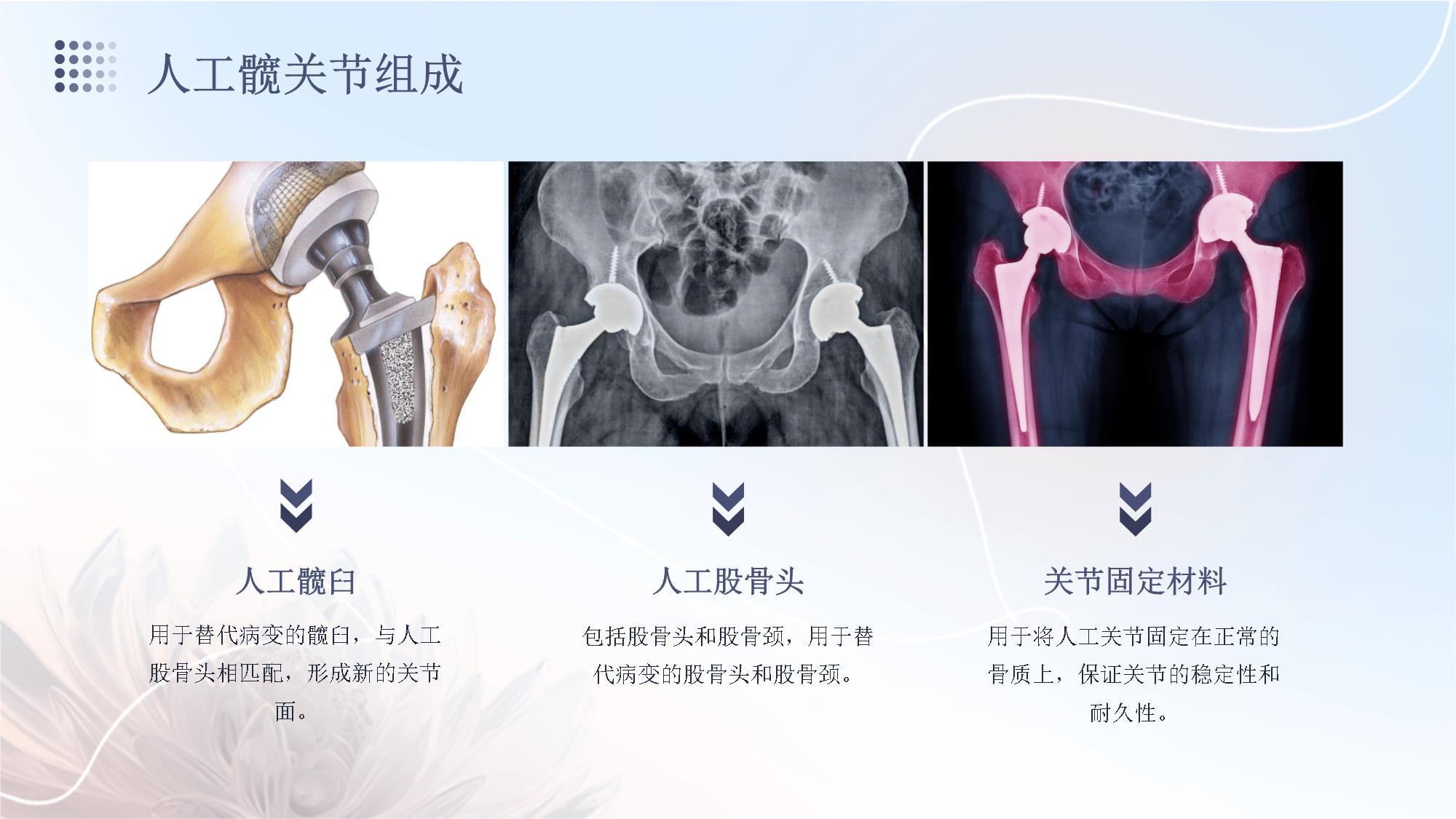 髋关节术后护理教程_第5页